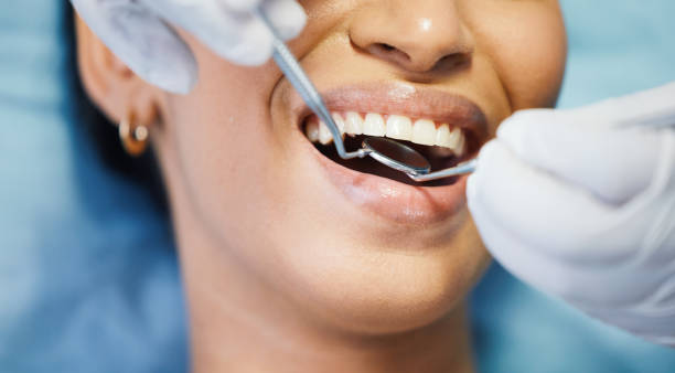 Best Emergency Root Canal Treatment in Deerfield, IL